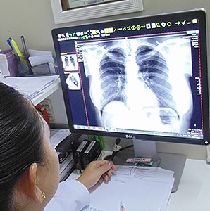 DR radiologia digital