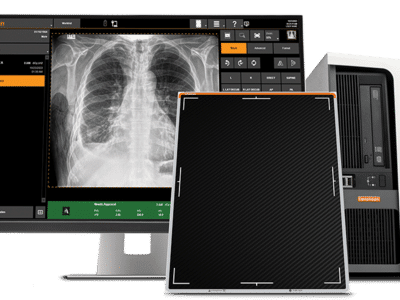 DR retrofit carestream