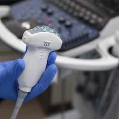 transdutor convexo p ultrassom