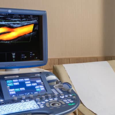 ultrassom portatil com doppler colorido- GE
