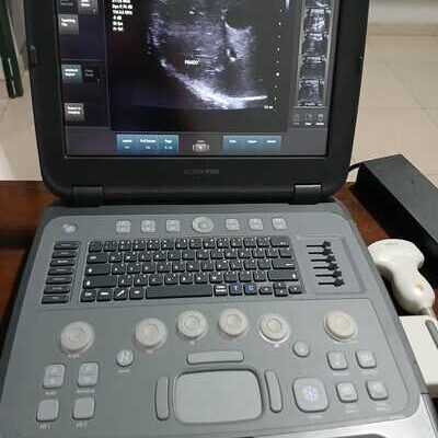 ultrassom portátil siemens