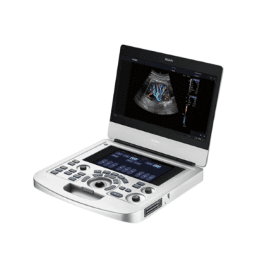 ultrassom portátil